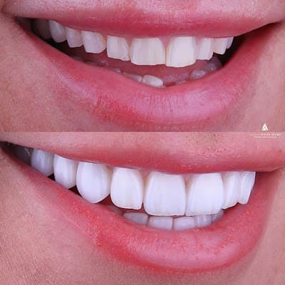 Alamo Dental Studio CDMX