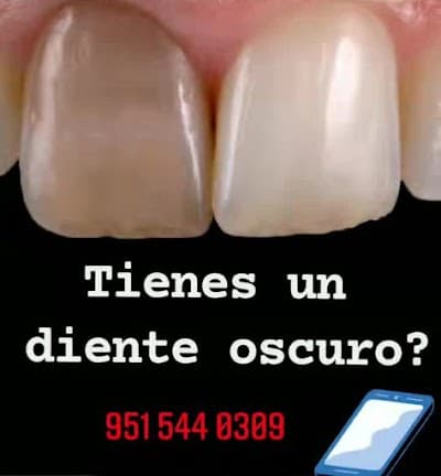 BG Dental Especializada en Santa Lucía del camino