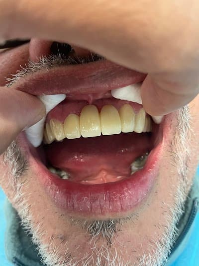 Clínica Dental XOLA (Dentalius) Dr Hugo Zaragoza