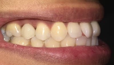 Consultorio Dental 24 horas 365 días mandar mensaje por WhatsApp