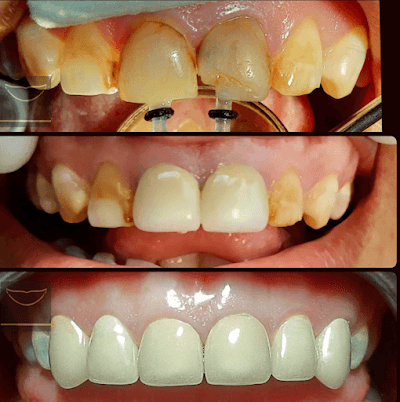 Consultorio Dental Acapulco dr Saudi