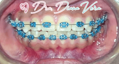 Dental Inn - Nezahualcoyotl