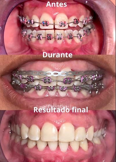 Dental Sonrisa bonita Azcapotzalco (:
