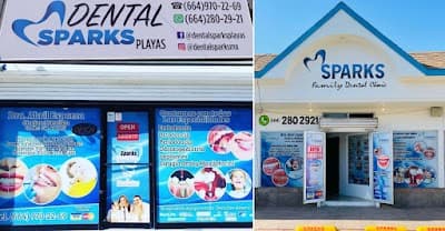 Dental Sparks Playas