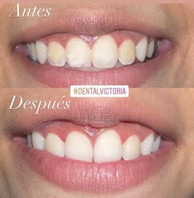 Dental victoria