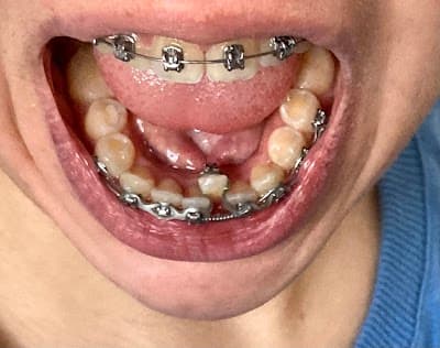 Dental World San Pedro