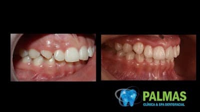 Dentista en Chilpancingo- Clínica Dental Palmas