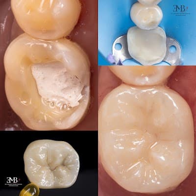 Dr. Eduardo Mendez-Odontologia Avanzada