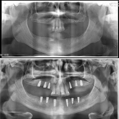 Dr.Leopoldo Vega - Dentista Ciudad Victoria