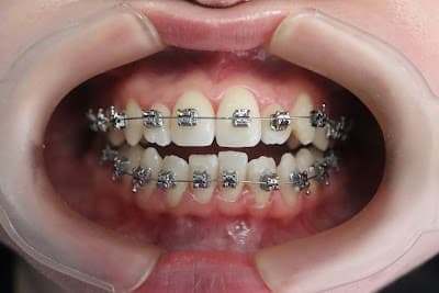 Dr. Marco Roldán, Dentista - Odontólogo