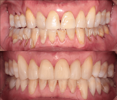 Dra. Aide Montserrat Orozco Gutierrez, Dentista - Odontólogo