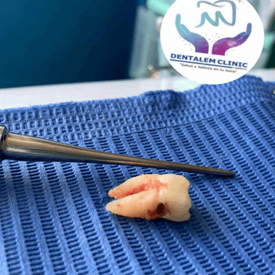 Dra. Alejandra Mancilla Dentalem (consultorio dental).