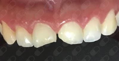 Dra. Jessica De La Barrera Valladolid, Dentista - Odontólogo