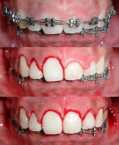 Dra Mayra Moreno - Ortodoncia Cuernavaca