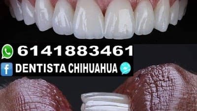 Elite Dental