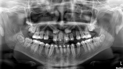 Especialidades Odontológicas SORRISO