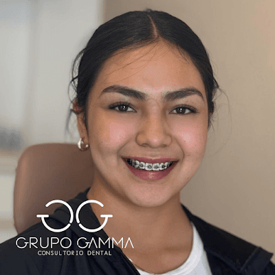 Grupo Dental Gamma Suc. San Miguel de Allende