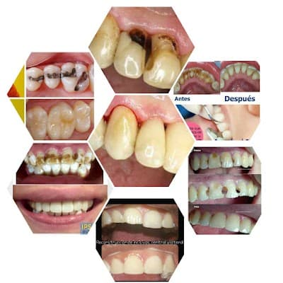 Innova Dental Tuxtepec