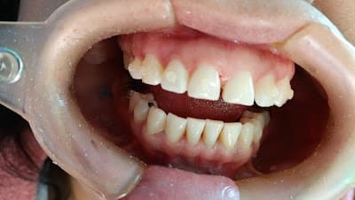 Odontología integral Dr Balcazar