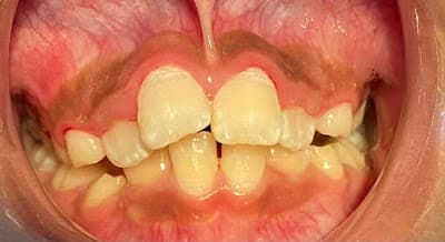 Odontopediatra Veracruz Dra. Cristina González Escalante