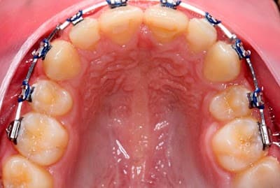 Ortodoncista en Ciudad Victoria - Dr. Raúl Carrillo