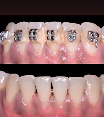 Perio & Smile Periodoncia y Rehabilitación Oral Puerto Vallarta