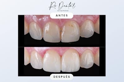 RO Dental - Dentistas en Cancún
