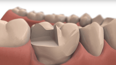 Aurodent. Dentista en San Miguel de Allende