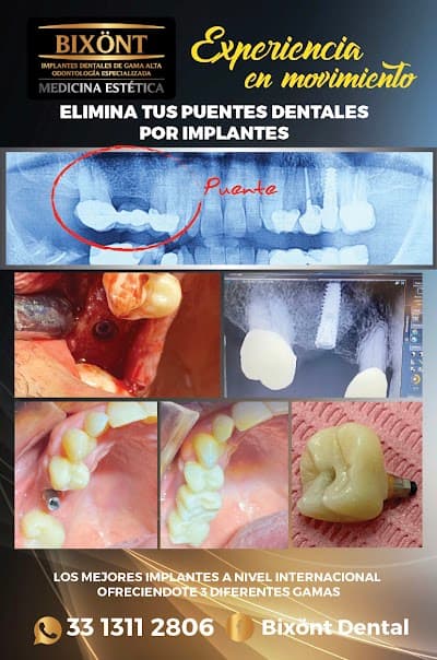 BIXÖNT DENTAL