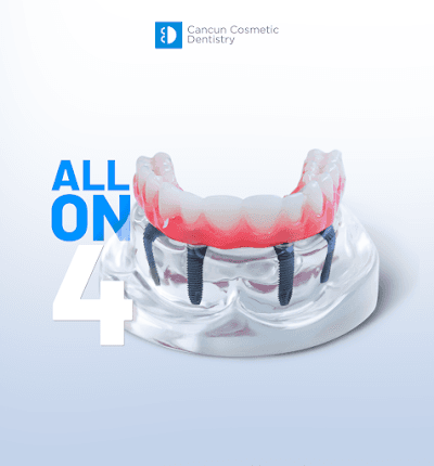 Cancun Cosmetic Dentistry