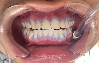 Consultorio Dental en Nezahualcóyotl | Larios Dent | Nezahualcótl Estado de México