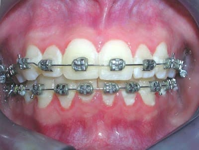 Dental Castrejon