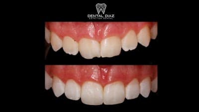 Dental Díaz Estética Dental - Dentista (Rehabilitación, Ortodoncia, Endodoncia, Periodoncia, Implantología)