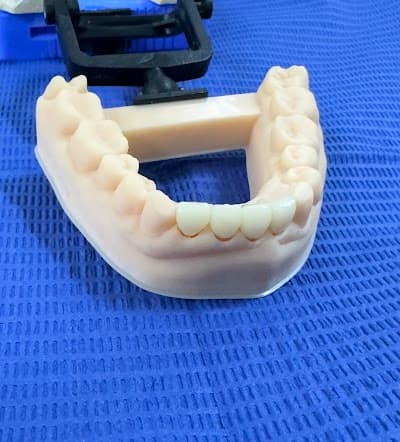 Dentista - Dr. Azael López Osorio ODONTOLOGÍA RESTAURADORA AVANZADA