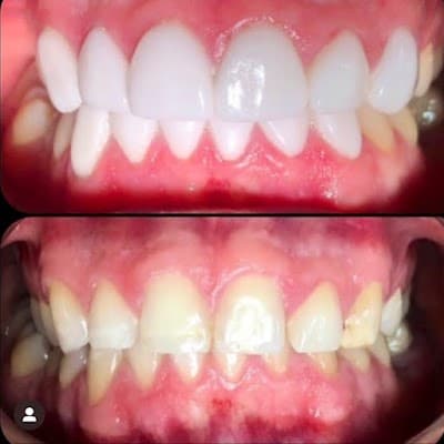 Dentistas Tijuana KL