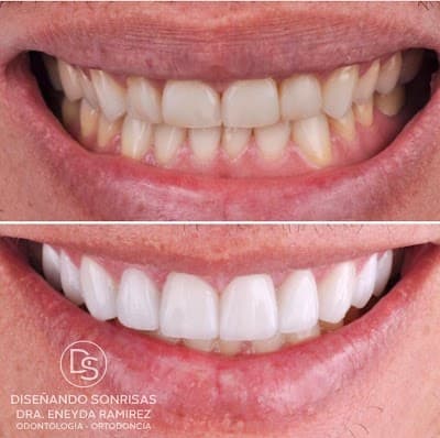 Dra. Eneyda Ramírez Montoya