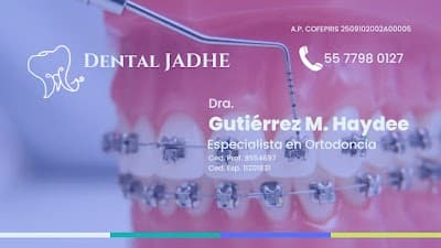 Ortodoncia, Brackets, Alineadores Xochimilco - Dra. Gutiérrez M. Haydee Especialista en Ortodoncia