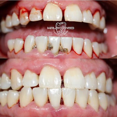 Consultorio Dental Maldonado