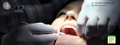 Dental Spa Playa del Carmen