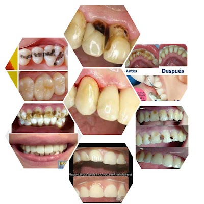 Innova Dental Tuxtepec